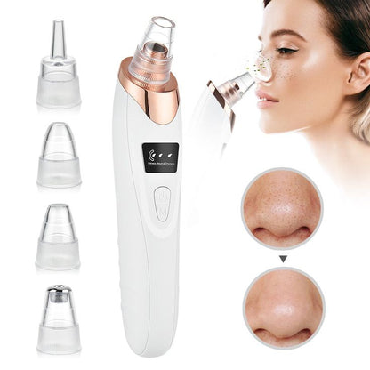 Electric Blackhead Remover Vacuum – 5 Head Pore Cleaner