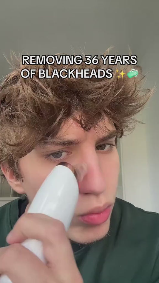 Electric Blackhead Remover Vacuum – 5 Head Pore Cleaner