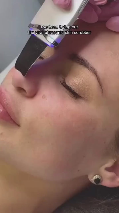 Ultrasonic Skin Scrubber – Peeling Blackhead Remover Acne Pore Cleaner Facial Shovel Cleanser